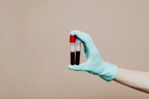 1 em cada 5 adultos tem lipoproteína a alta e o exame de colesterol não detecta 1 em cada 5 adultos tem lipoproteína a alta e o exame de colesterol não detecta